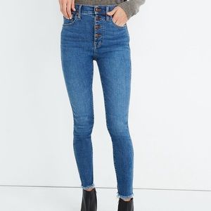 Madewell Button-Front High-Rise Skinny Jeans